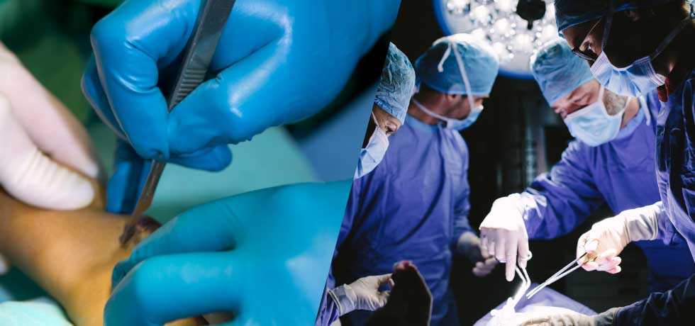 The Differences Between Interventional Radiology and Traditional Surgery